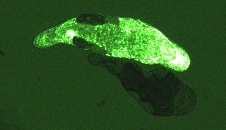 Worms with and without GFP marker